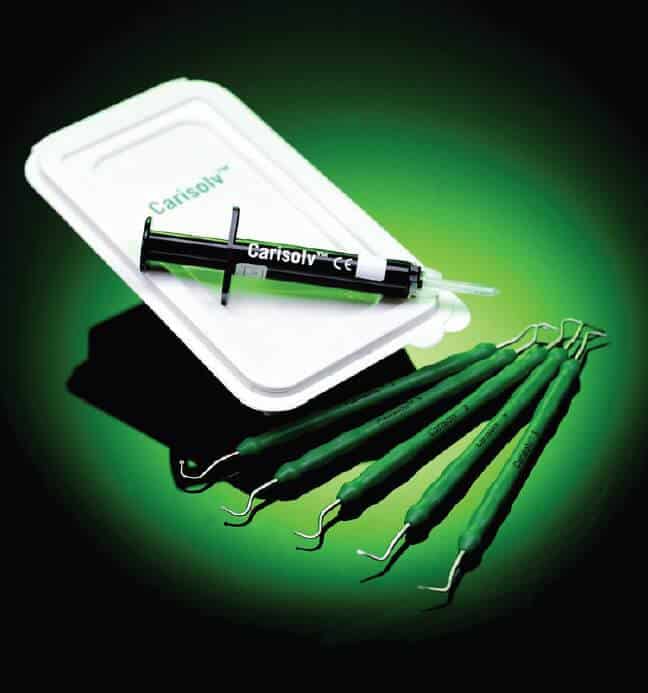 El Carisolv permite disolver de forma muy controlada y conservadora el tejido dental con caries, respetando los tejidos dentales sanos El Carisolv permite disolver de forma muy controlada y conservadora el tejido dental con caries, respetando los tejidos dentales sanos