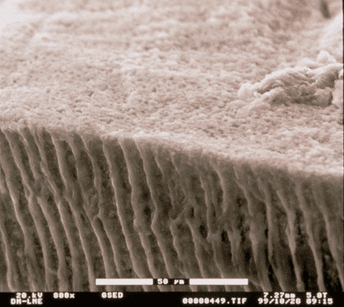 Fotografía de los túbulos de la dentina de los dientes vista al microscopio electrónico de barrido ambiental. (Estudio de Clínica Dental Padrós) Fotografía de los túbulos de la dentina de los dientes vista al microscopio electrónico de barrido ambiental. (Estudio de Clínica Dental Padrós)