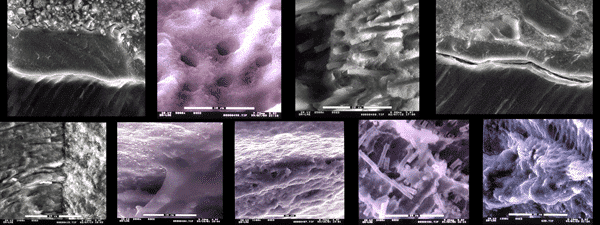 Estas son una muestra de algunas de las imágenes de una investigación realizada en clínica dental Padrós con un microscopio electrónico y que fué publicado en una de las revistas científicas nacionales y extranjeras Estas son una muestra de algunas de las imágenes de una investigación realizada en clínica dental Padrós con un microscopio electrónico y que fué publicado en una de las revistas científicas nacionales y extranjeras