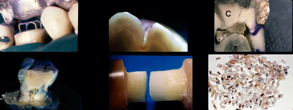 Estas son una muestra de algunas de las imágenes de diferentes estudios realizados por la clínica dental Padrós y publicados en las revistas científicas nacionales y extranjeras Estas son una muestra de algunas de las imágenes de diferentes estudios realizados por la clínica dental Padrós y publicados en las revistas científicas nacionales y extranjeras