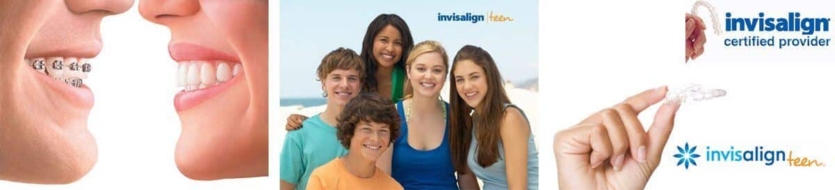 La clínica dental Padrós en Barcelona dispone del tratamiento de ortodoncia invisible invisalign, aparatos transparentes y removibles La clínica dental Padrós en Barcelona dispone del tratamiento de ortodoncia invisible invisalign, aparatos transparentes y removibles