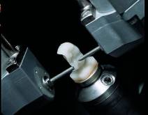 Imágenes de un caso real en clínica dental Padrós con el sistema CEREC CAD-CAM. Con el uso del software de diseño podemos mejorar el diseño y creación de restauraciones dentales, especialmente prótesis dentales incluyendo coronas, carillas, puentes, implantes y aparatos de ortodoncia Imágenes de un caso real en clínica dental Padrós con el sistema CEREC CAD-CAM. Con el uso del software de diseño podemos mejorar el diseño y creación de restauraciones dentales, especialmente prótesis dentales incluyendo coronas, carillas, puentes, implantes y aparatos de ortodoncia
