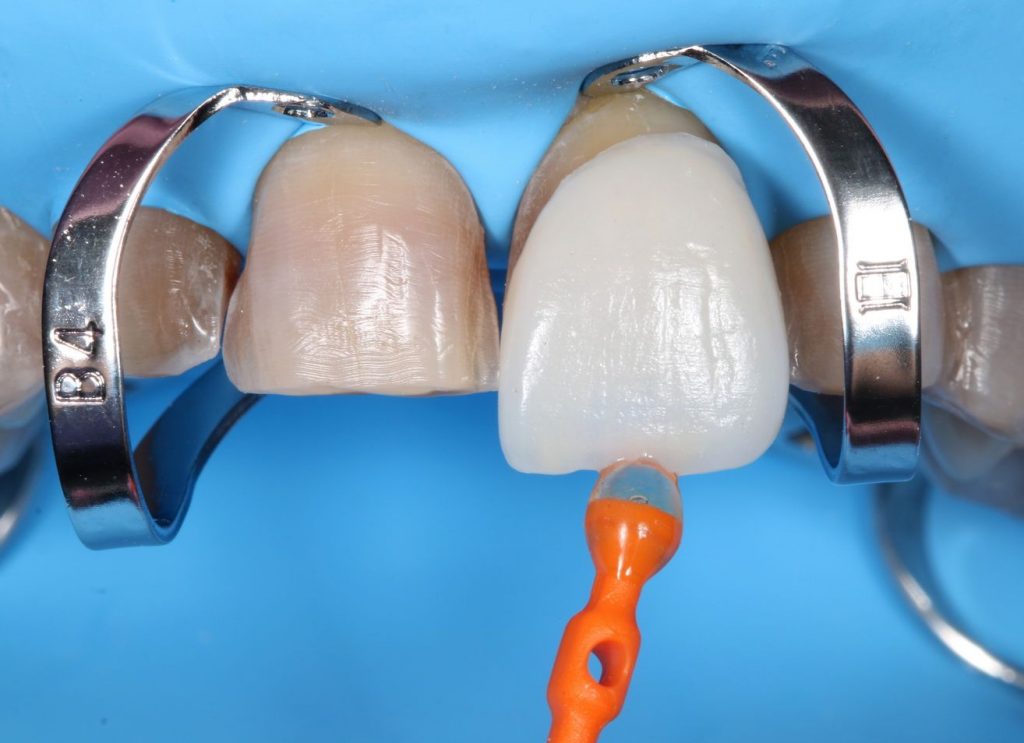 Curso de estética y prótesis dental Curso de estética y prótesis dental