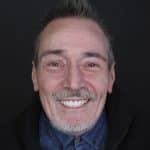 Caso dental Joaquín: tratamiento de estética dental