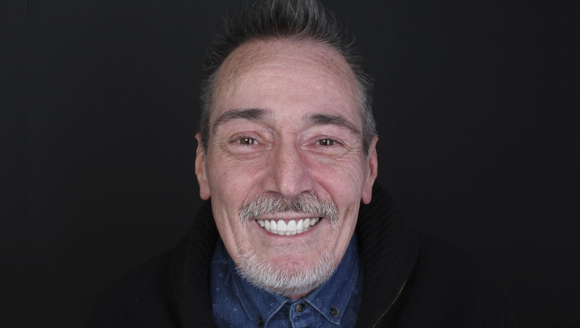 Joaquín después del tratamiento de estética dental Joaquín después del tratamiento de estética dental