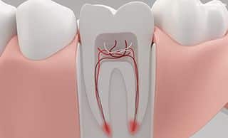 Endodoncia