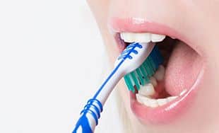 Caries dental