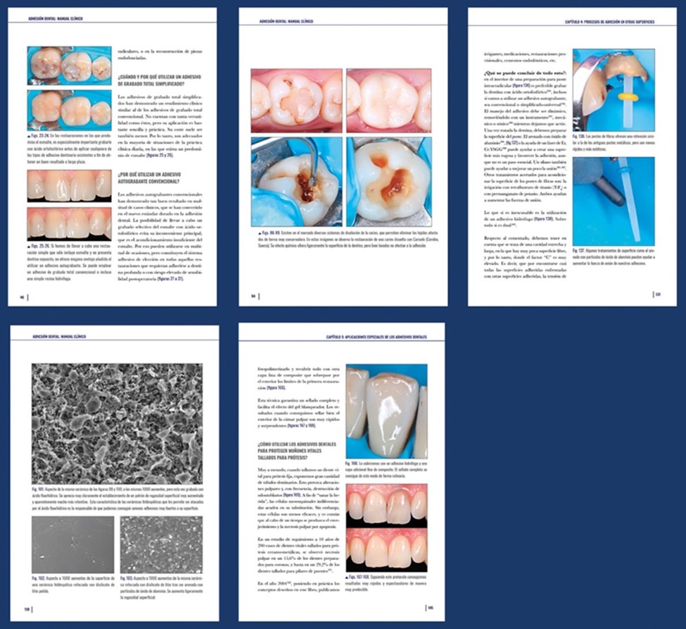 portada del libro Adhesión dental, pautas de actuación clínica. Publicación del libro por Ed. Ediciones Especializadas Europeas 2009